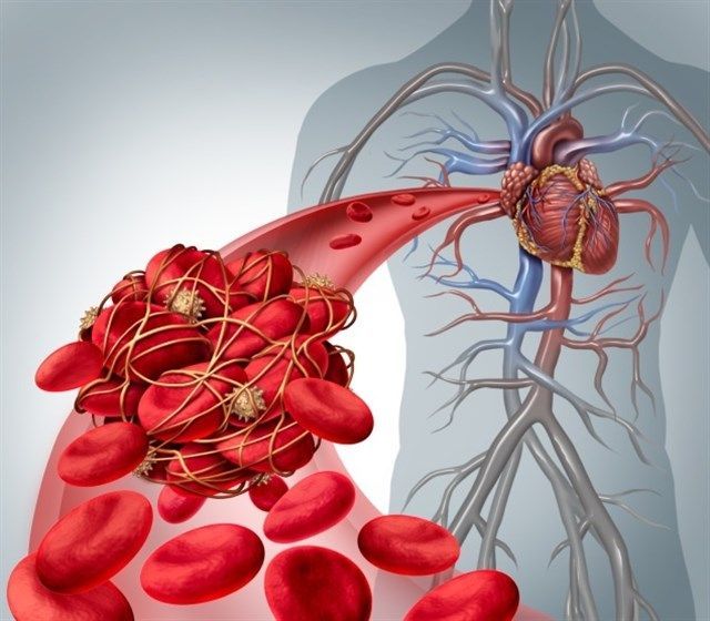 Sintrom y alimentación