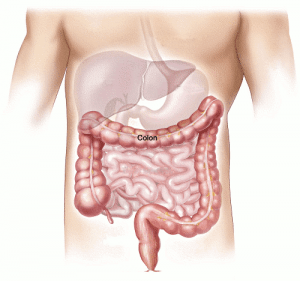 Tengo colon irritable: ¿qué hago?